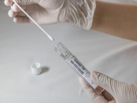 teste PCR